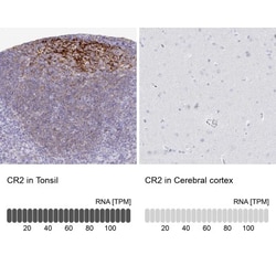 CD21 Antibody, Novus Biologicals:Anticorps:Anticorps primaires